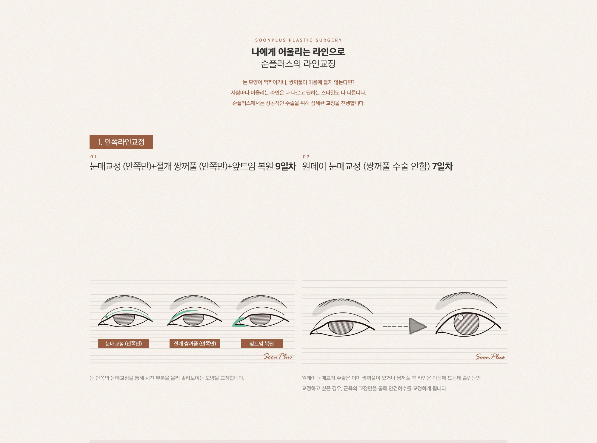 순플러스 라인 교정