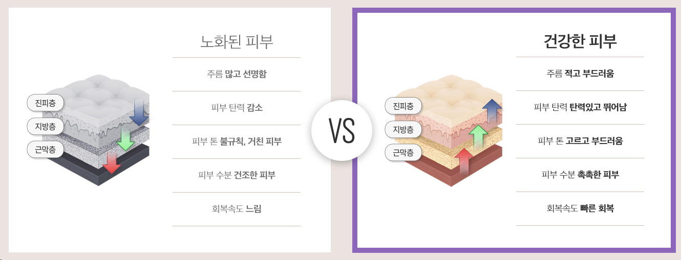 노화된 피부와 건강한 피부의 진피 지방층 근막층 비교